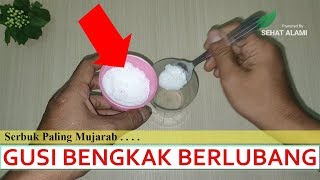 Download lagu Cara Cepat Mengobati Gusi Bengkak dan Gigi Berlubang Secara Alami | Gusi Bengkak, Kempes Seketika mp3