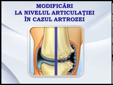 Inflamația articulației falangelui degetelor