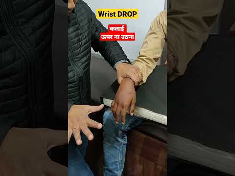 😱 Wrist Drop Case 🖐️ #shorts