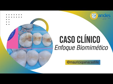 NUEVO Caso Clínico con Enfoque Biomimético