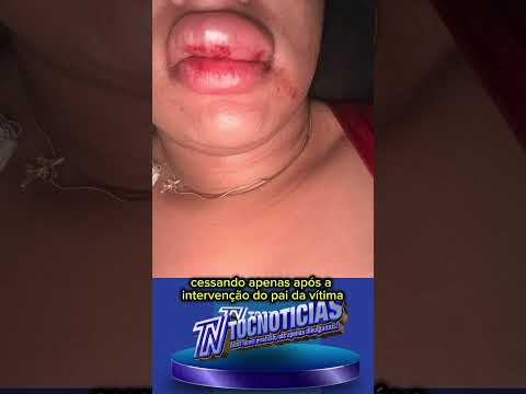 Vereador é acusado de agredir namorada com socos e chutes em Maurilândia do Tocantins