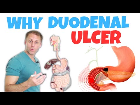 Understanding a Duodenal Ulcer