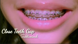 °°Close Teeth Gap°°subliminal••