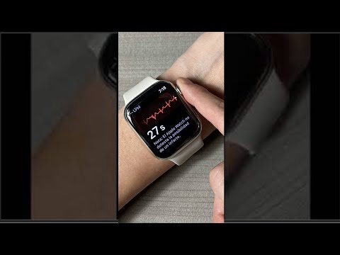 Cómo hacer un ECG con tu Apple Watch paso a paso