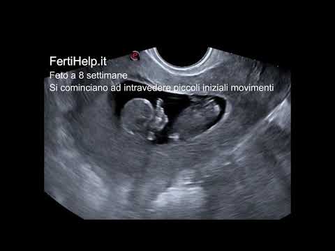 ecografia feto 8 settimane