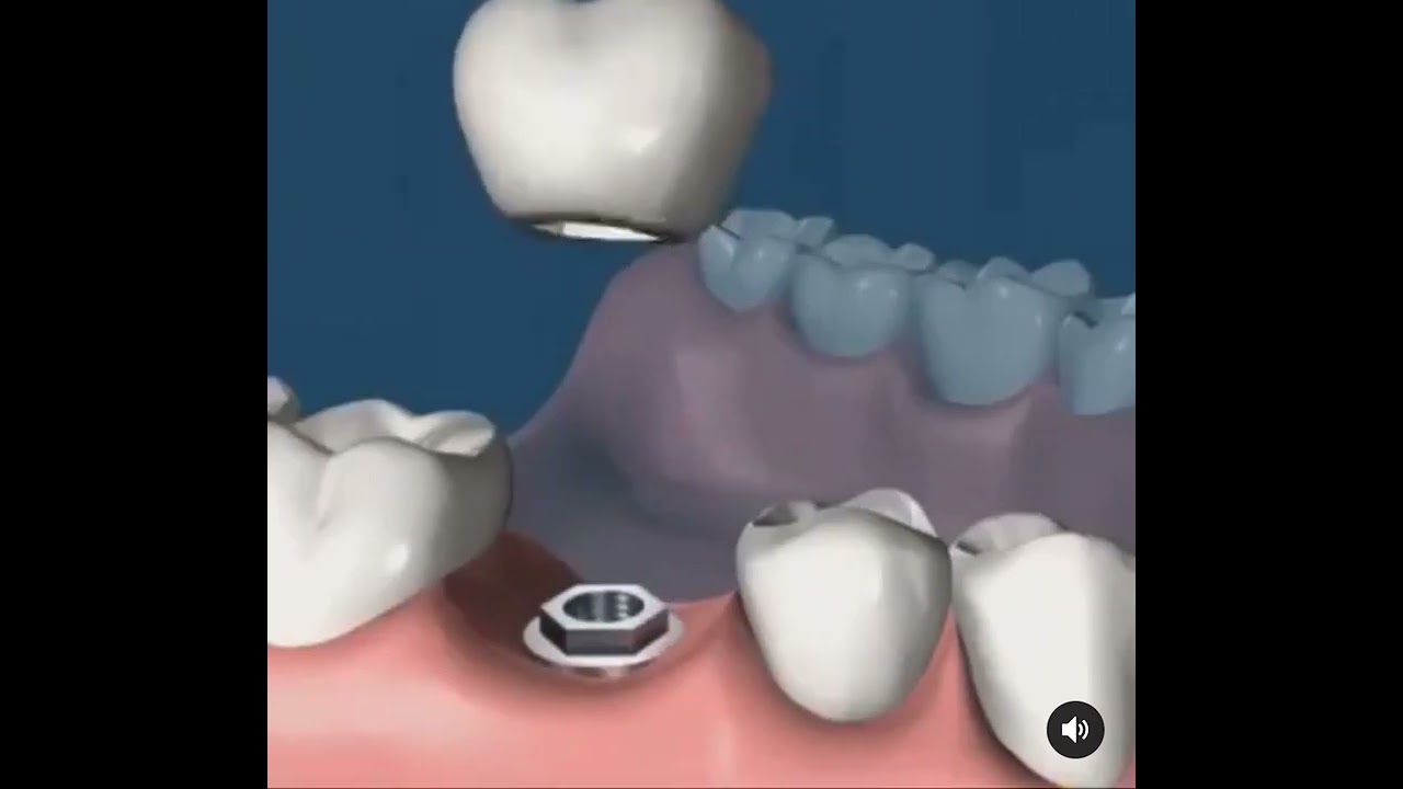 Leandro Ponte Dias-49