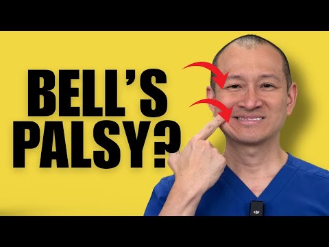 Facial Exercises For Bell’s Palsy