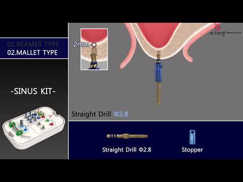Crestal Approach Sinus Kit - Haenaem Co., Ltd.