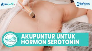 Mengenal Manfaat Akupuntur untuk Kesehatan Tubuh: Atasi Asma hingga Turunkan Berat Badan
