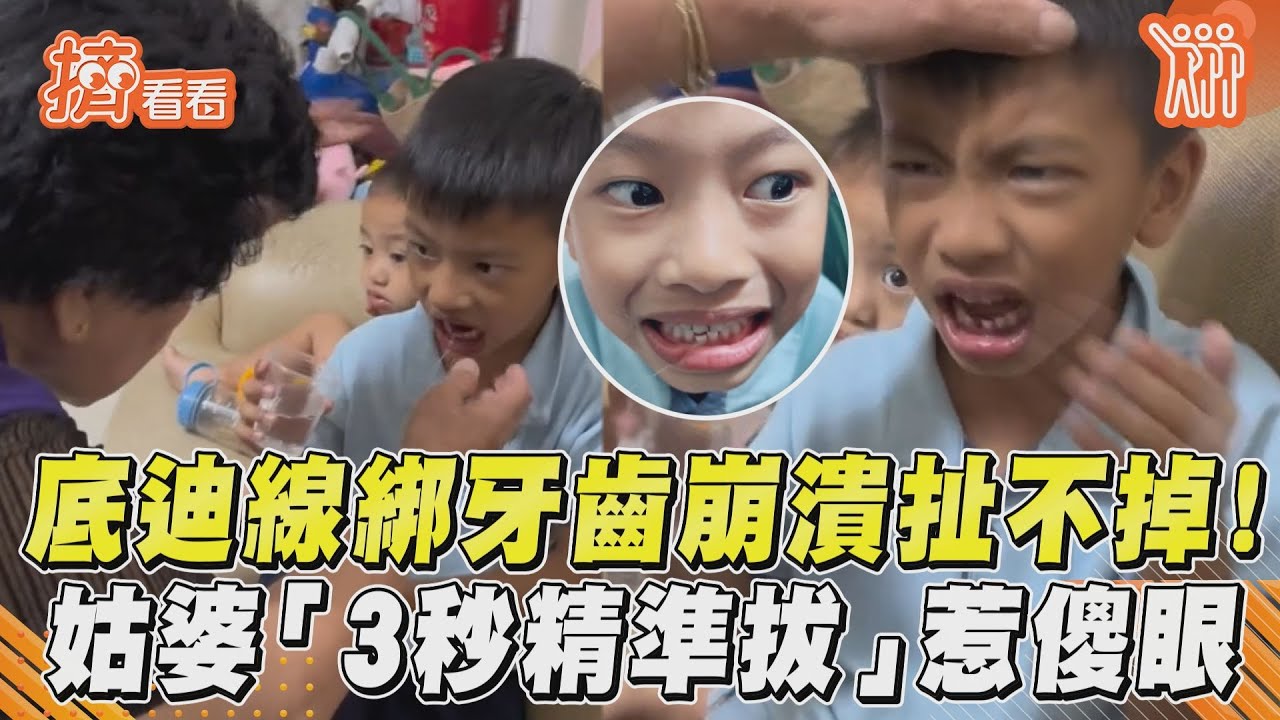 影音/底迪線綁牙齒崩潰扯不掉! 姑婆「3秒精準拔」惹傻眼