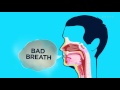 Health Detective The Science Behind Coffee Breath