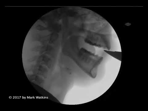 Chapter 2: 04 EMBOUCHURE: Subtone