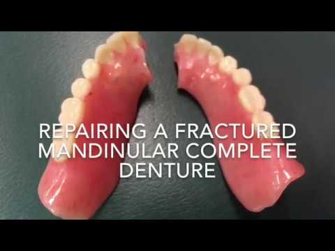 Repairing a fractured denture