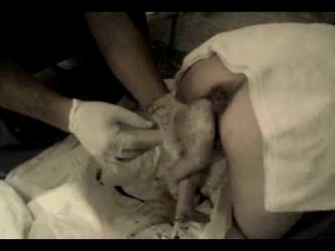 Videos: Essential Birth Prep - Breech Birth Network