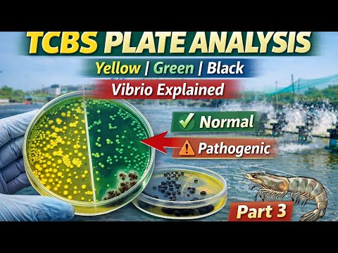 TCBS Agar Plate Analysis | Yellow, Green & Black Colonies Explained | Vibrio – Part 3