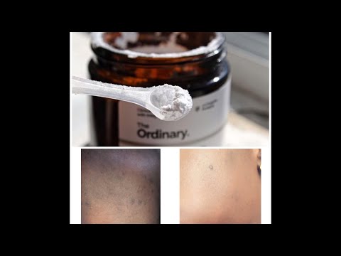 Coated ascorbic acid