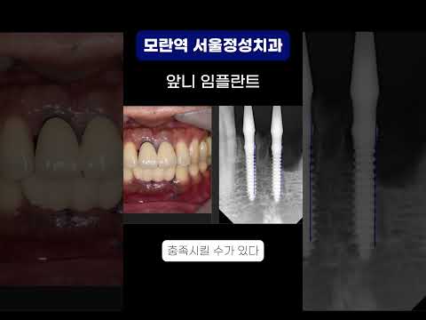 땡큐성형외과 Clips