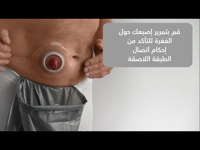 سنسورا ميو كليك كيس البول قطعتين كبير كتالوج : 114...