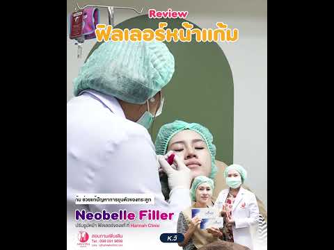 รีวิวหัตถการโปรแกรม Filler หน้าแก้ม
