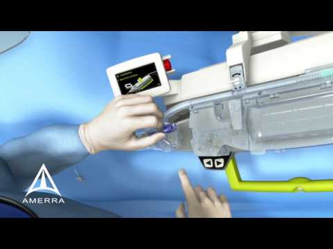 Corindus CorPath GRX Video 2150