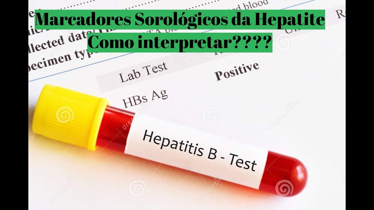 Marcadores Sorológicos das Hepatites Virais - Entenda o significado de cada um deles!!!