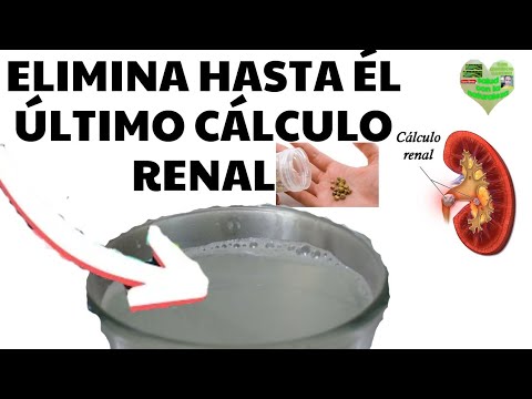 Four natural remedies to effectively eliminate kidney stones in 2019