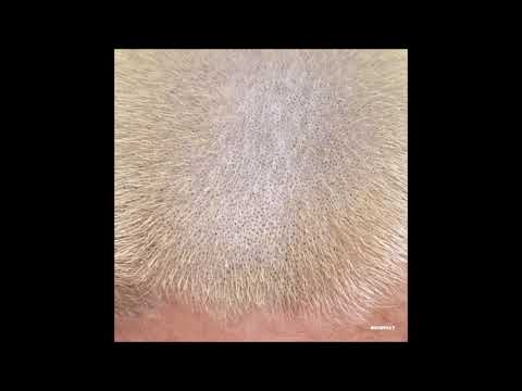 Barnt - You Know What's Gone [KOMPAKT442]