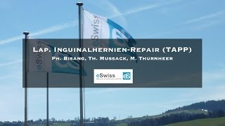 preview picture of video 'Laparoskopische Leistenbruch-Operation (TAPP) - eSwiss, St. Gallen'