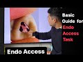 Endo Access Task BASIC GUIDE With ADC Part 2 Exam