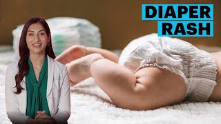 Diaper Rash Symptoms and Remedies | The Parents Guide | Parents