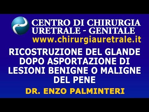 Piccolo male cazzo Arifon influenzano la potenza