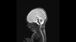 Case of the Day - 18 Nov 24
