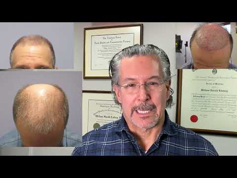 2 guys at 6 months out from Dr Lindsey hair restoration looking great | McLean | VA | MD | DC thumbnail