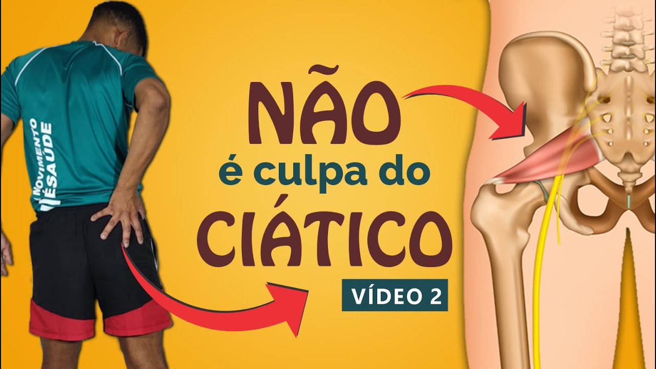 Sua dor nem sempre é o ciático  |  Síndrome do piriforme | Exercícios para aliviar a dor e a tensão
