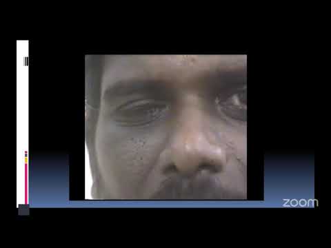 FINE - Neurology Grand Rounds by Dr M Madhusudanan