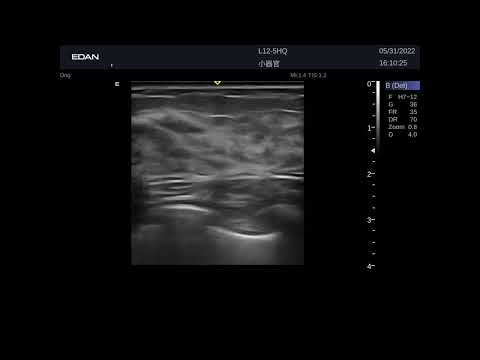 Кинопетли Edan Acclarix LX9 Поверхностные органы, сосуды, нервы