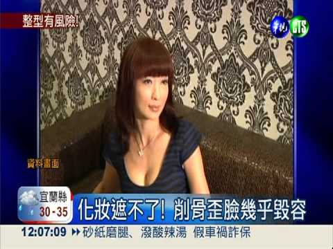 整型整到失敗! 愛美竟毀容