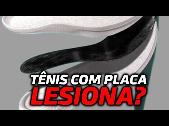 TÊNIS DE PLACA LESIONA? Ft. Dra. Ana Paula Simões