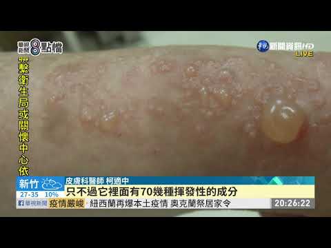 偏方消炎止痛 敷「左手香」反紅腫