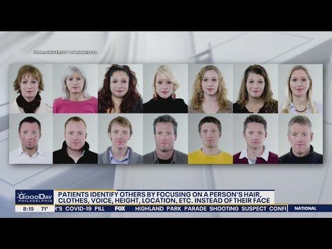 Face Blindness: Understanding Prosopagnosia and its effects