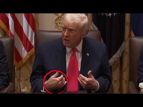 President Trump's Bruised Hand Covered With Band-Aids
