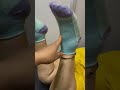 Knee Pain Treatment By Dr Arti Sharma