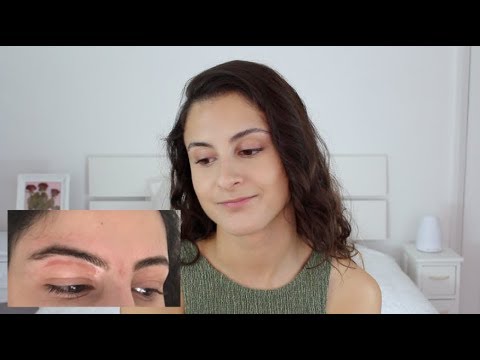 Vitamin a- cautions & side effects/ waxing skin off