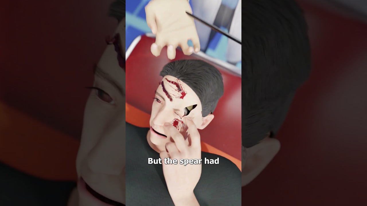 A Harpoon Went Through His Skull 😵