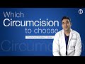 Which Type Of Circumcision Is Best Classic Stapler Or Laser