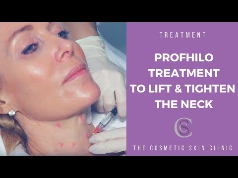 Profhilo Skin Tightening