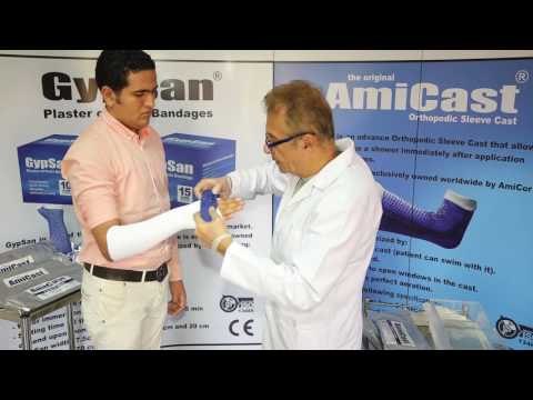 the AmiCast (below elbow application) - thumb spica.