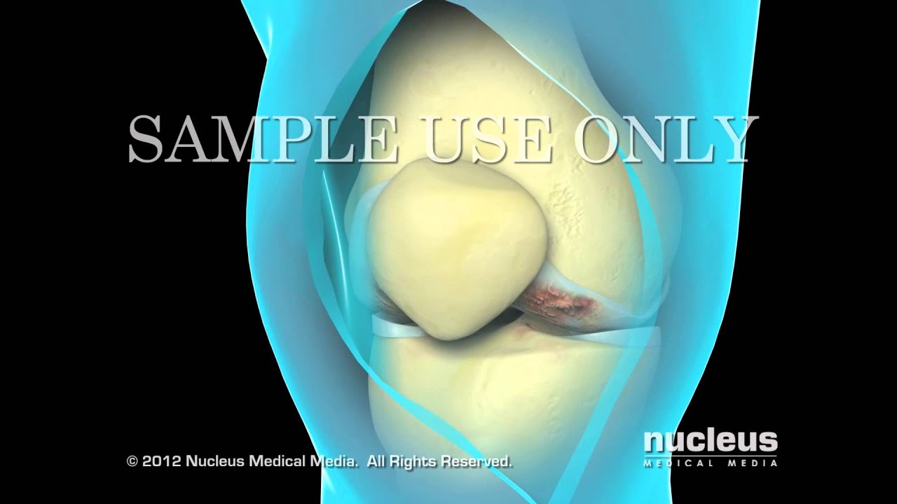 Marco Antonio Altamirano Cruz-23