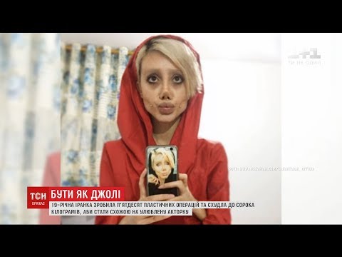 Іранська дівчина перенесла 50 пластичних операцій, аби бути схожою на Анджеліну Джолі