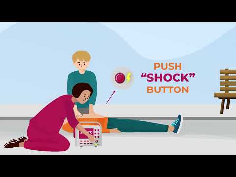 What are the steps of using an AED?